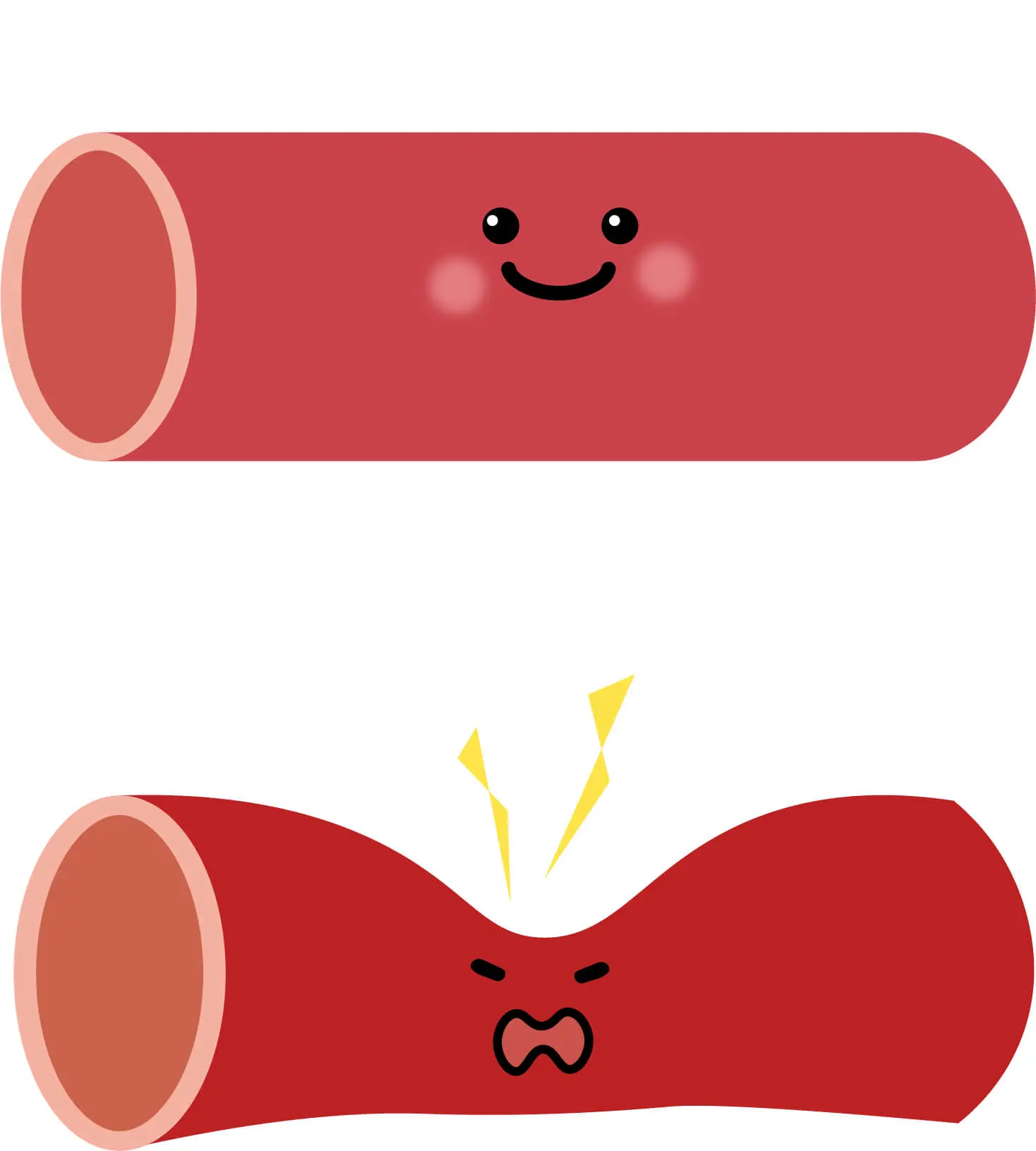 リンパ管の図