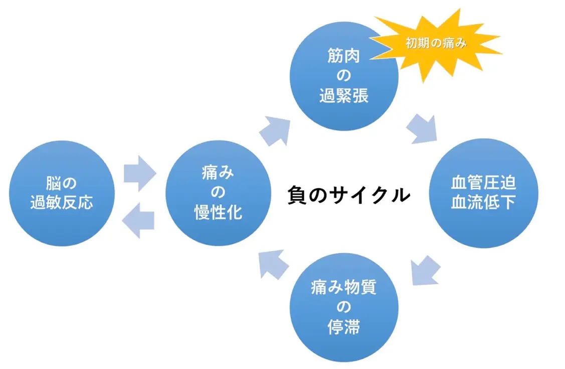 膝の痛みが慢性化する仕組み