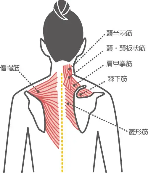 背中の筋肉図