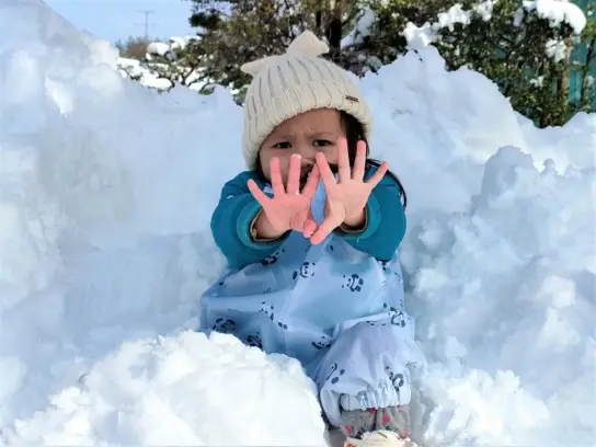 てのしもやけを見せる子供