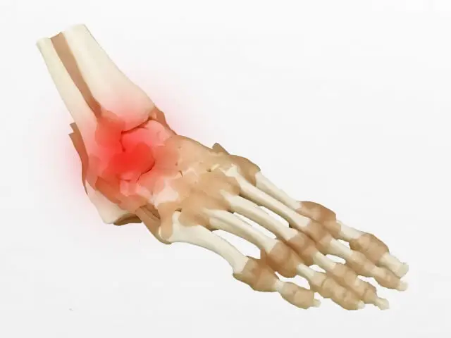 足首周りの骨と腱のイラスト図