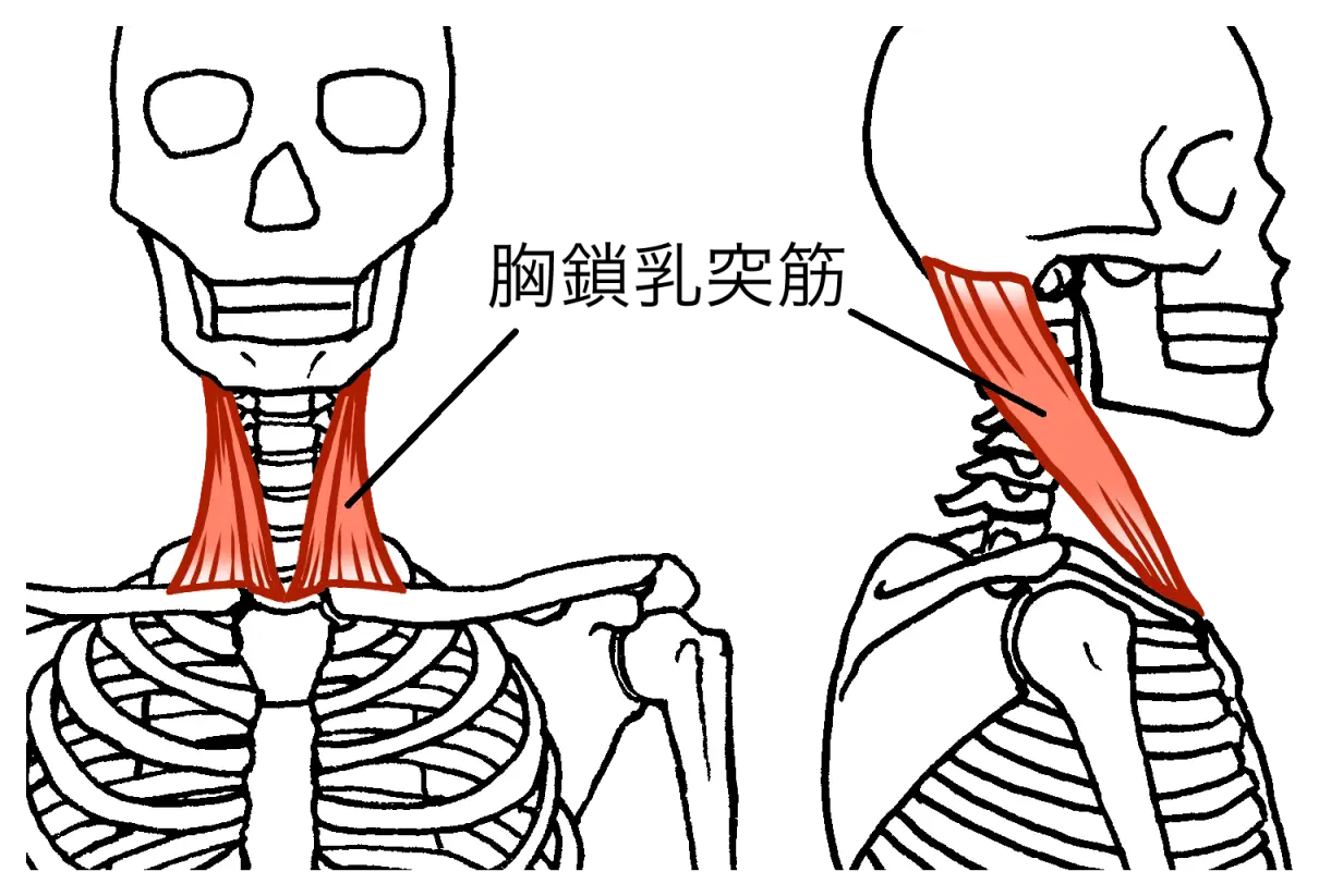 首こりに関係のある筋肉ー胸鎖乳突筋のイラスト図