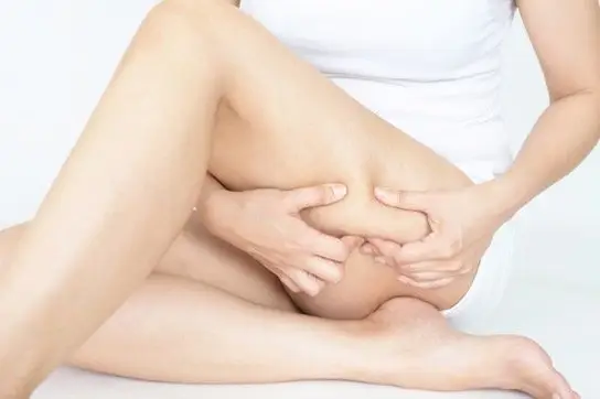 太ももをつまんで、セルライトのでこぼこを確かめる女性